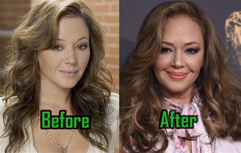leah remini before and after plastic surgery